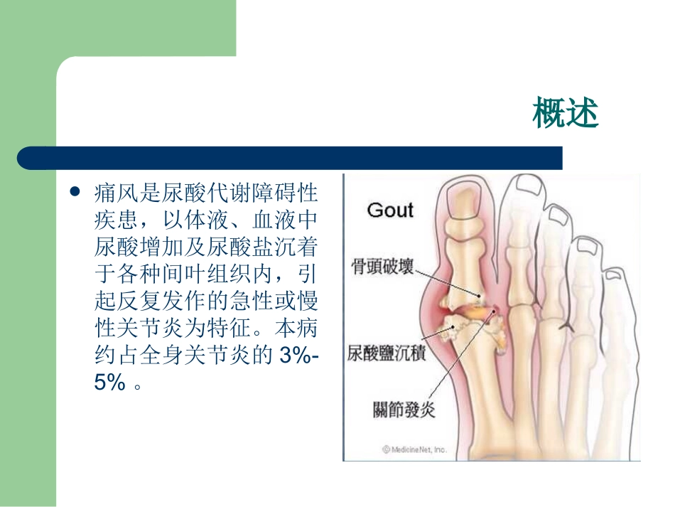 痛风结节的影像表现要点_第2页