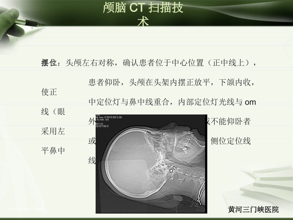 头颅CT报告解读_第2页