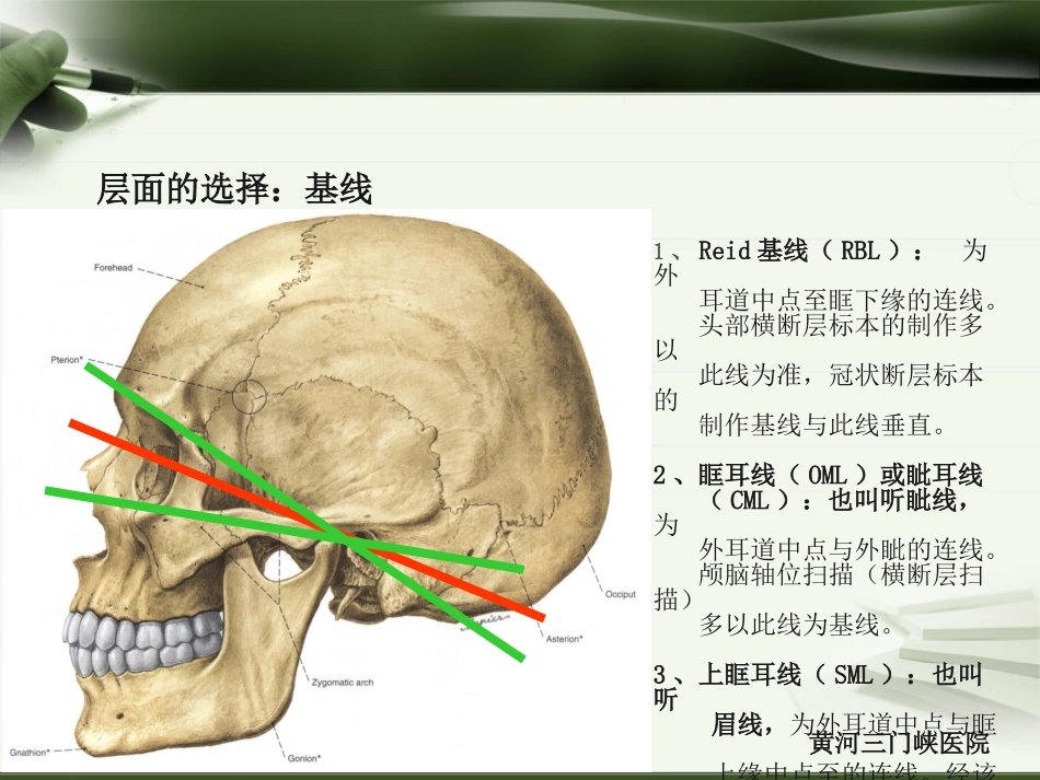 头颅CT报告解读_第3页