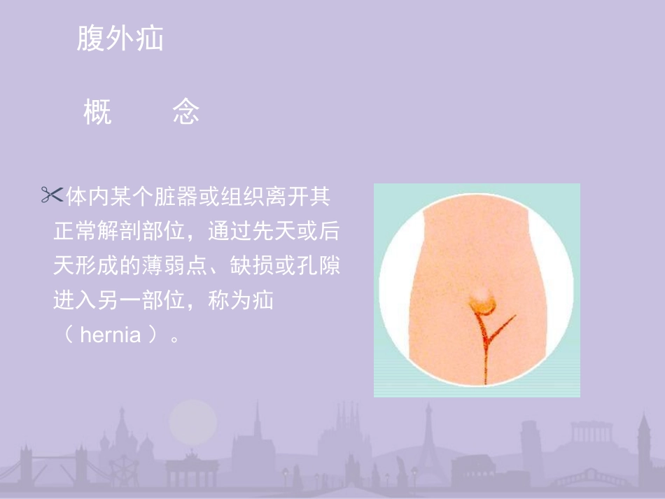 外科学课件腹外疝斜疝直疝股疝_第3页