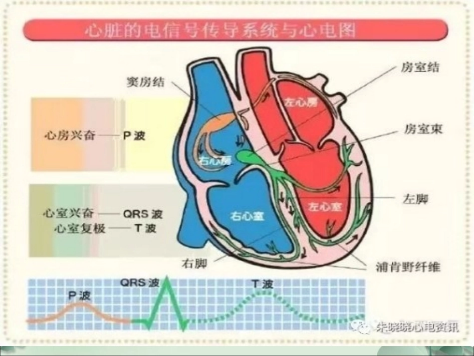围术期常见心律失常的诊疗和治疗_第3页