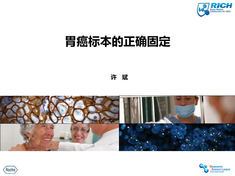 胃癌标本的正确固定许分析_第1页