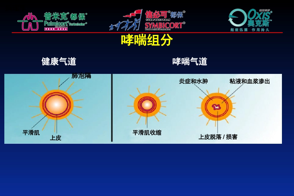 吸入装置特点_第3页