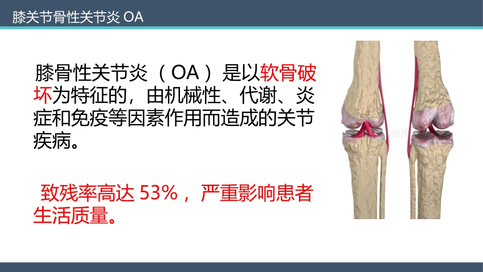 膝关节骨性关节炎HTO治疗_第3页