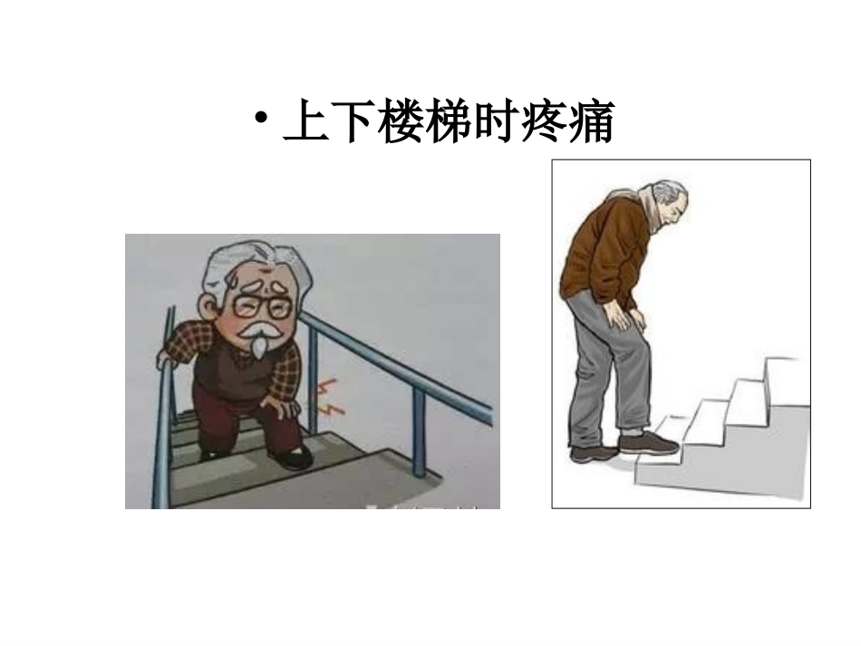 膝关节骨性关节炎的防治_第3页