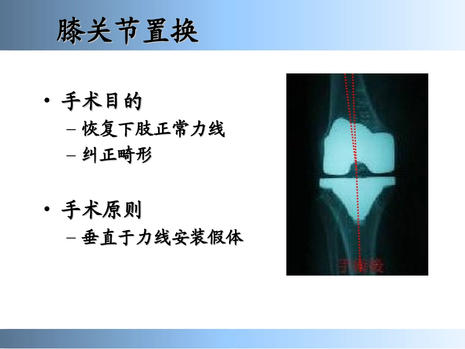 膝关节置换标准技术_第3页
