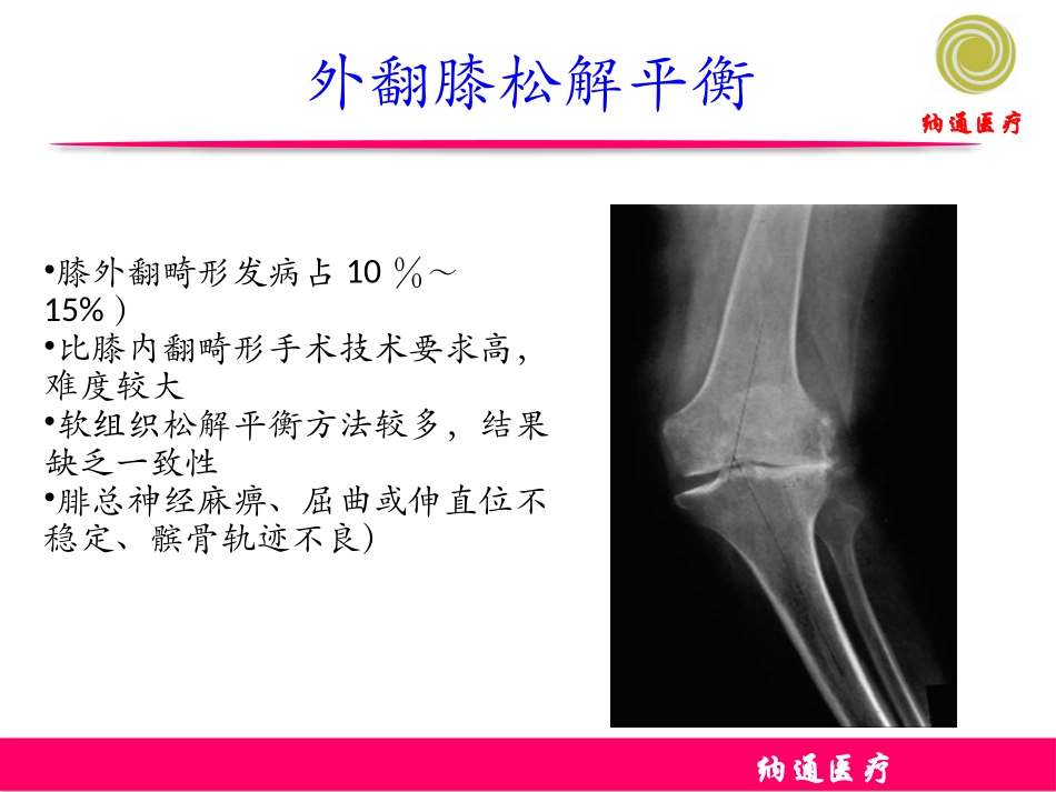 膝关节置换的松解平衡_第2页