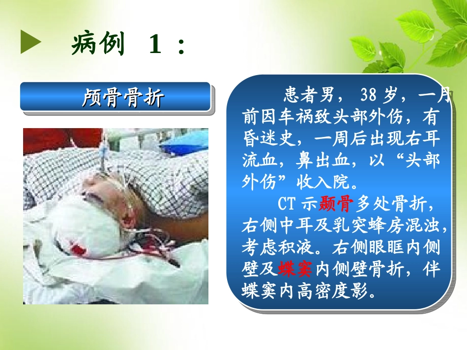 系统解剖学颅骨课件_第3页