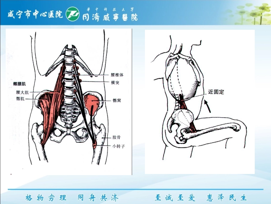 下交叉综合征_第3页