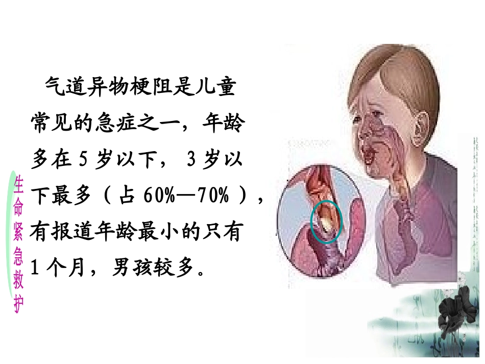 小儿气管异物的紧急处置_第2页