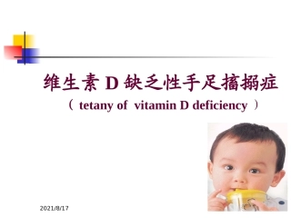 小儿缺钙维生素D缺乏性手足搐搦症