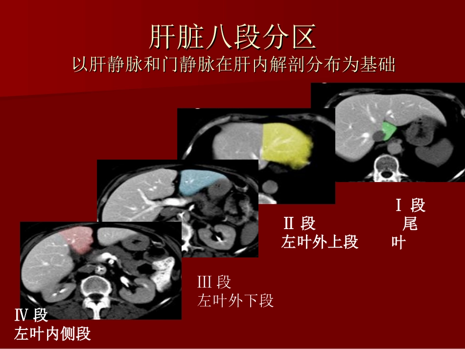 小肝癌多排螺旋CT诊疗CT_第3页