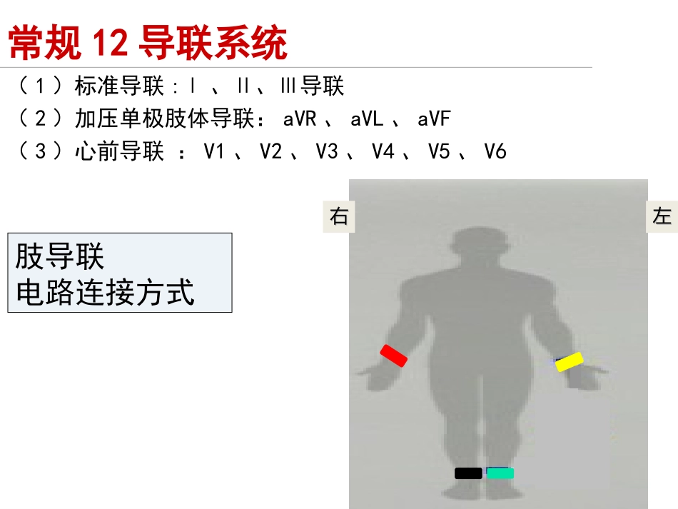 心电图和心律失常课件_第3页