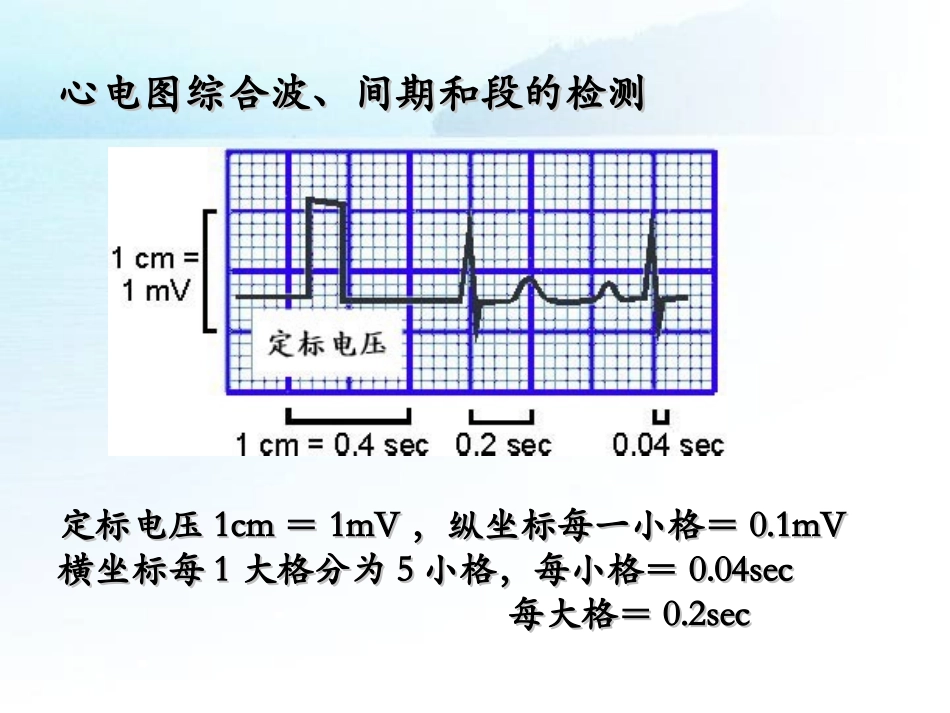 心电图心律失常的识别_第3页