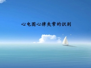 心电图心律失常的识别