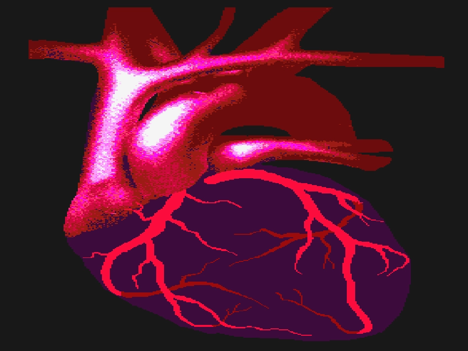 心绞痛和急性心肌梗死的识别课件_第2页