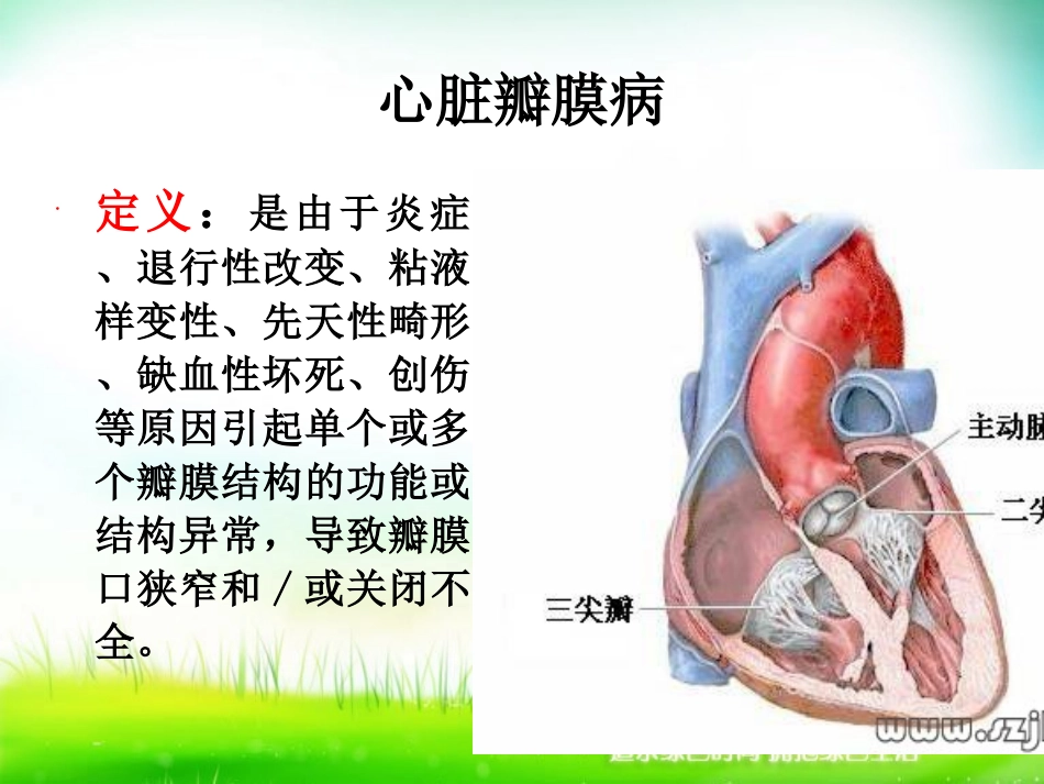 心脏瓣膜病病人的护理_第3页