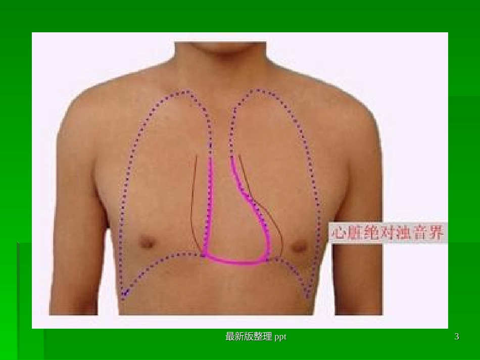 心脏叩诊听诊诊疗学查体_第3页