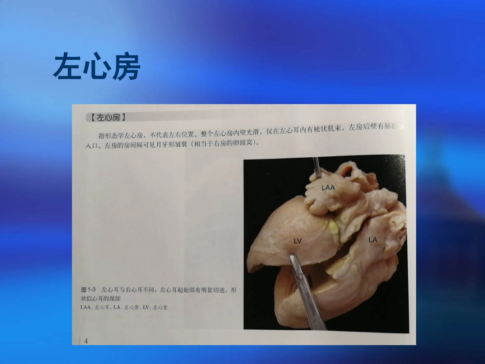 心脏三维解剖分析左心_第3页