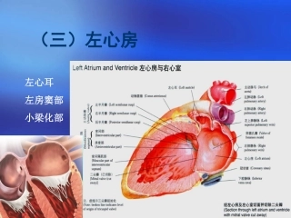 心脏三维解剖分析左心