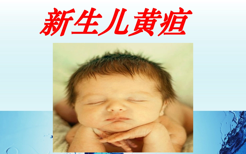 新生儿黄疸精选课件_第1页
