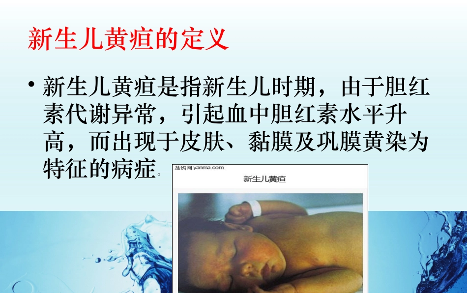 新生儿黄疸精选课件_第3页