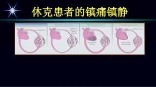 休克患者的镇痛镇静