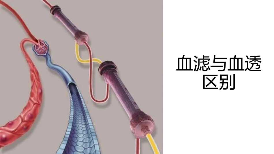 血滤和血透的区别_第1页