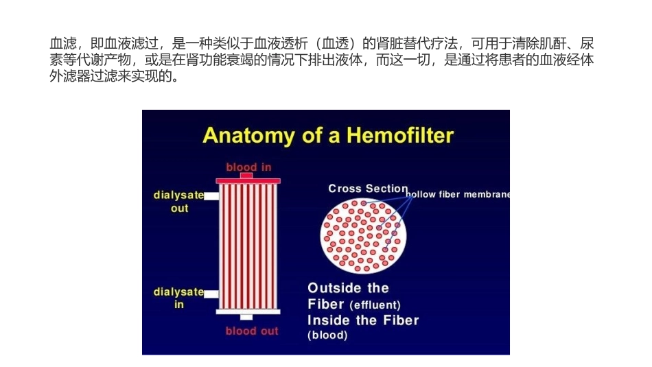 血滤和血透的区别_第2页