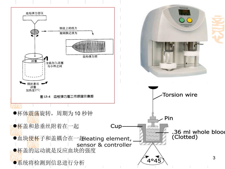 血栓弹力图课件分析_第2页