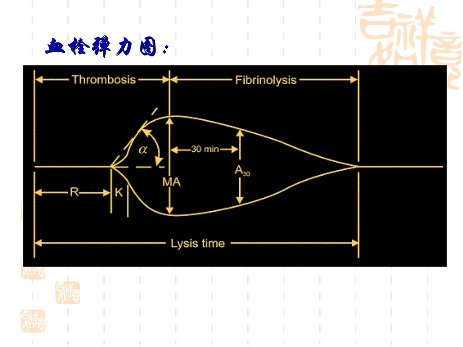 血栓弹力图课件分析_第3页
