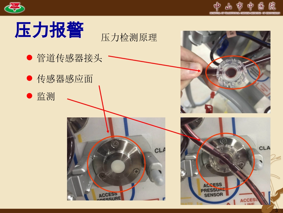 血液净化常见报警及处置_第3页