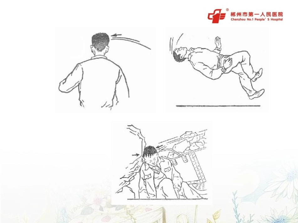 严重颅脑损伤ICU处置_第3页