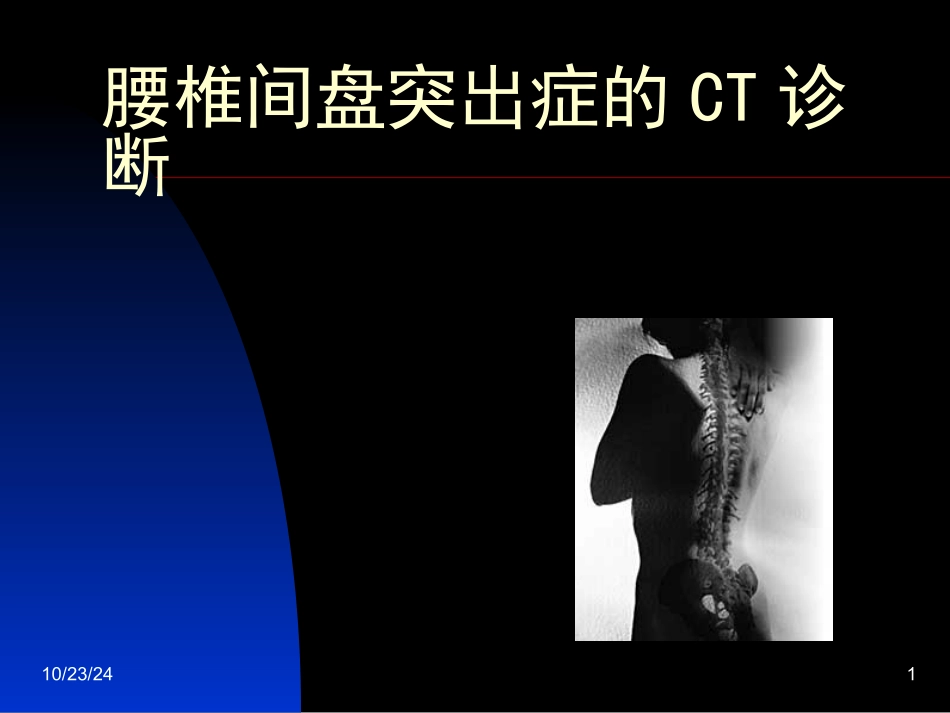 腰椎间盘突出症的CT诊疗_第1页