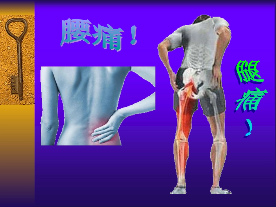 腰椎间盘突出症教学课件_第2页