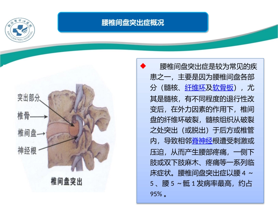腰椎间盘突出症症状诊疗治疗_第3页