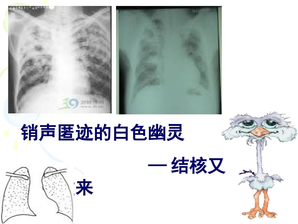 药理学抗结核药物_第2页
