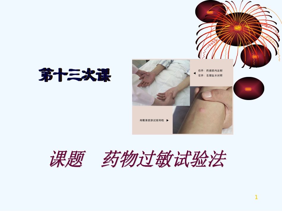 药物过敏试验法_第1页