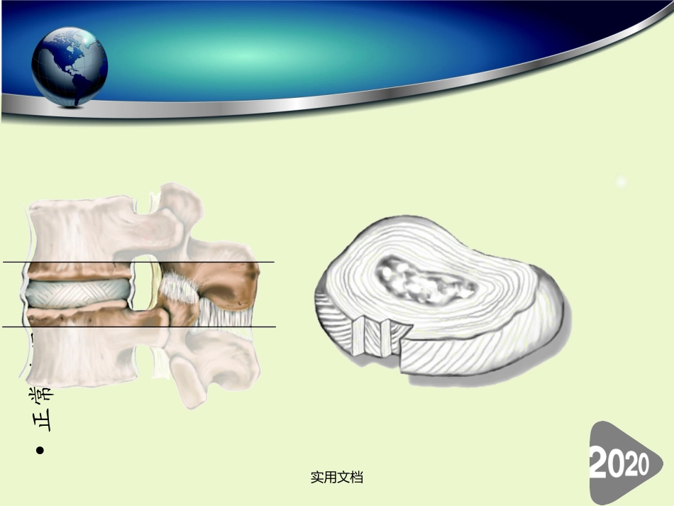 一次性纤维环缝合器_第2页