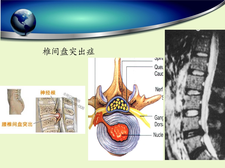 一次性纤维环缝合器_第3页