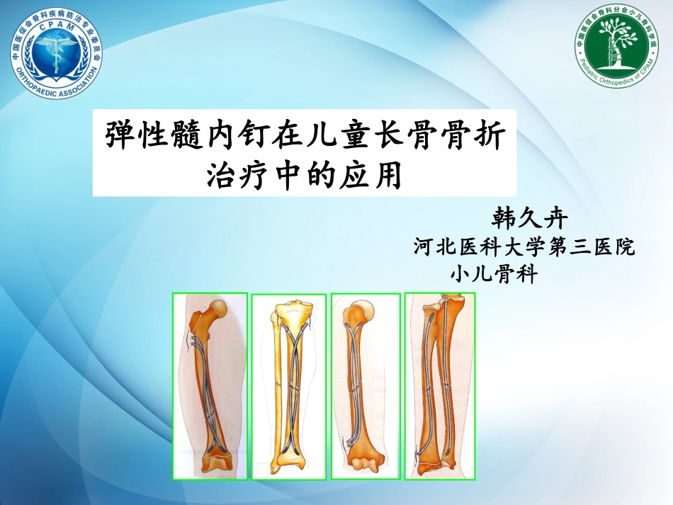 医促会弹性髓内钉规范化操作_第1页