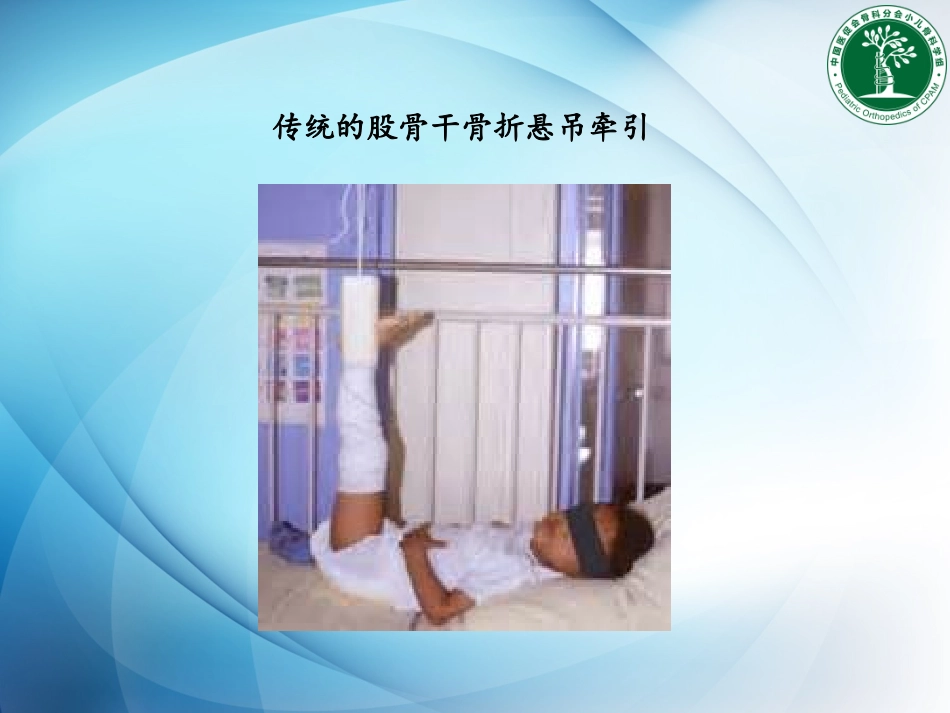 医促会弹性髓内钉规范化操作_第3页