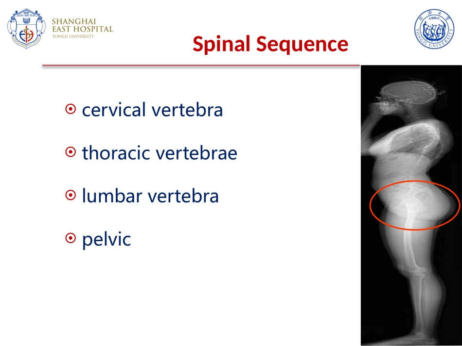 医学颈椎病英文版_第2页