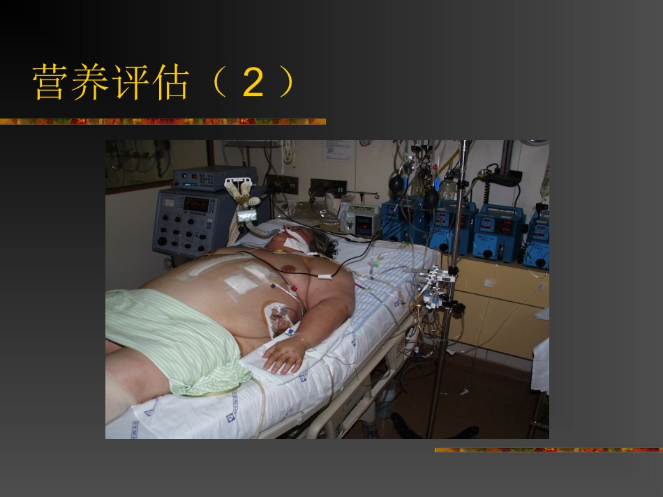 医学课件外科学总论外科营养_第3页