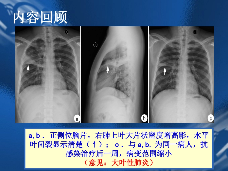 医学影像诊疗学呼吸系统_第1页