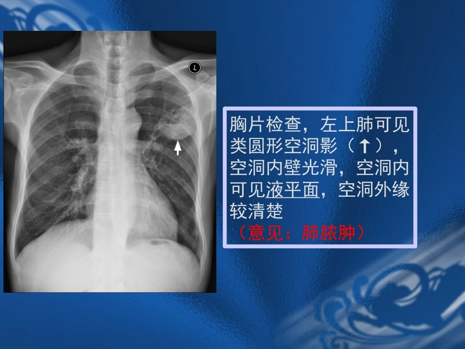医学影像诊疗学呼吸系统_第3页
