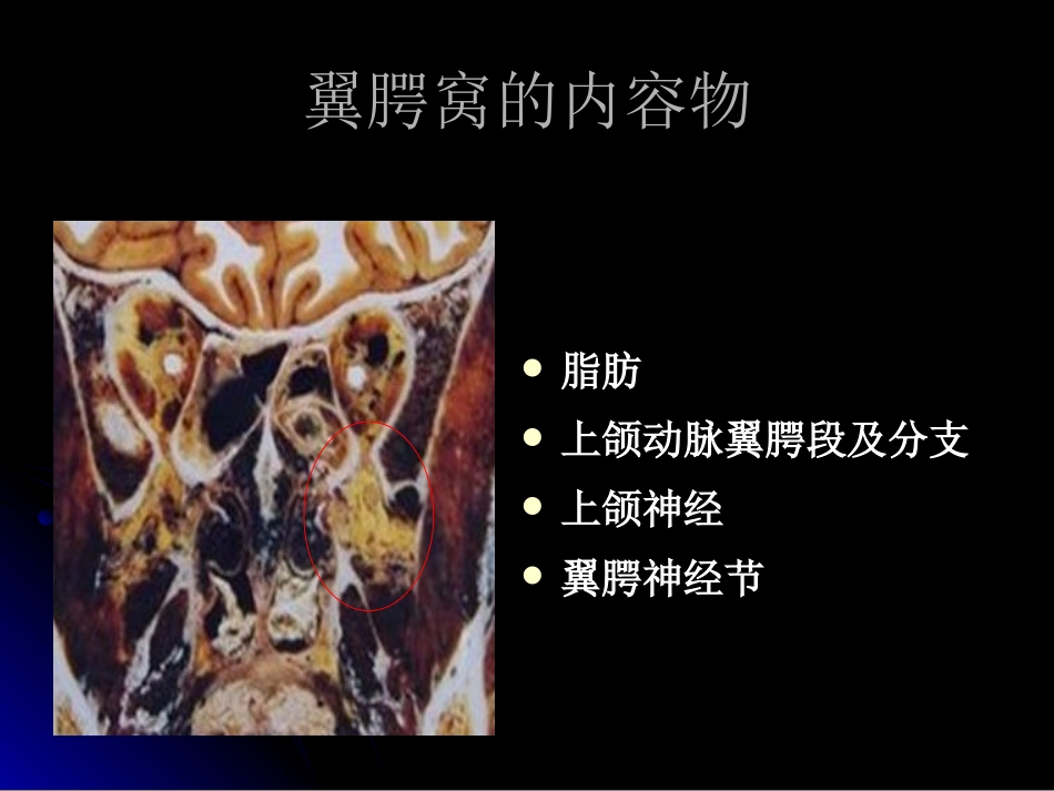 翼腭窝的解剖和影像识别_第3页