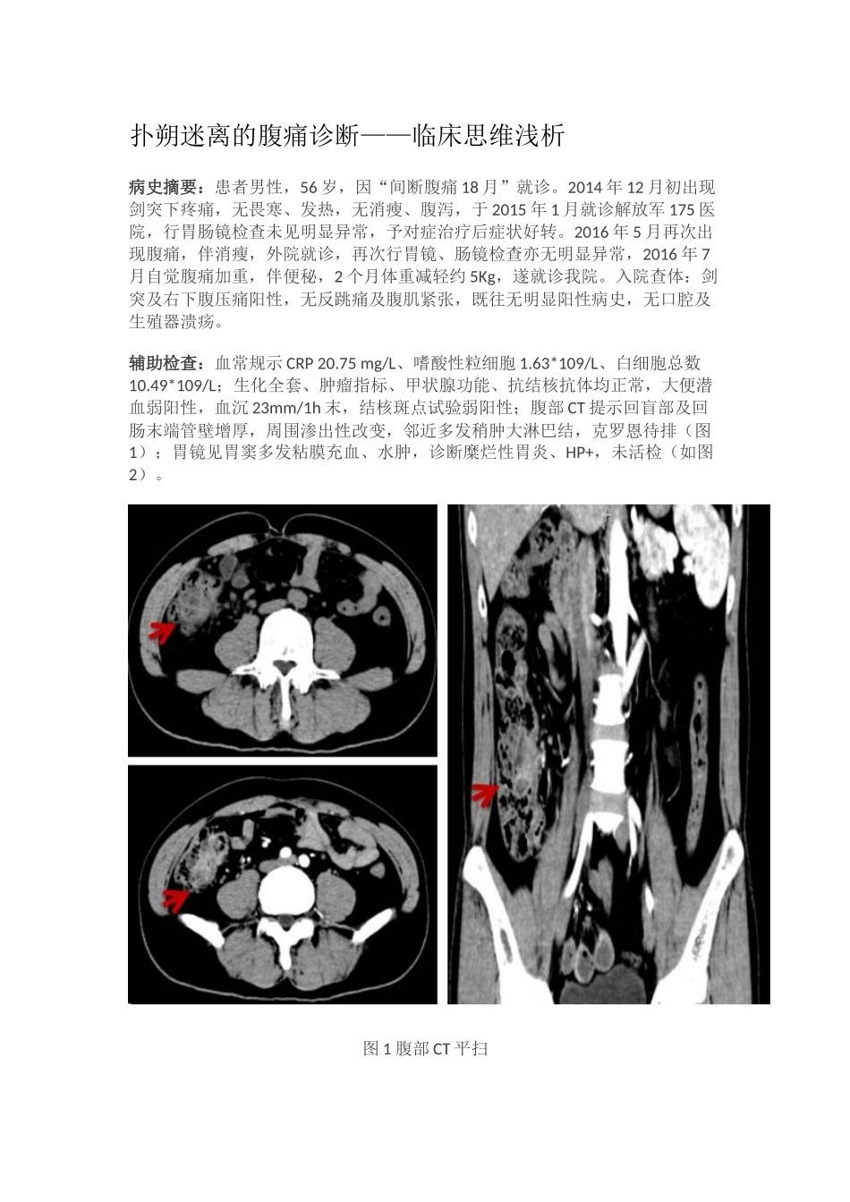 嗜酸性粒细胞胃肠炎_第1页