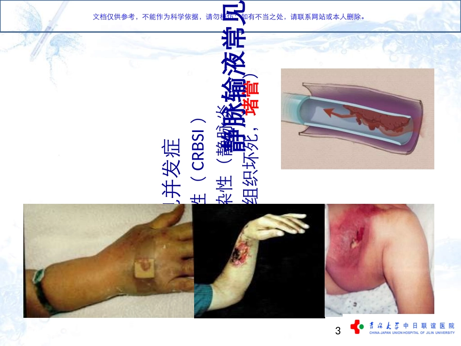 ACL导管维护金标准课件_第3页