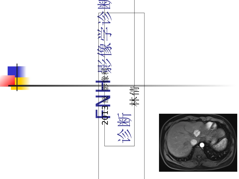 FNH影像学诊断及鉴别诊断_第1页